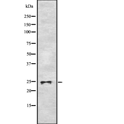 Polyclonal Rabbit anti-Human ASCL1 / MASH1 Antibody (IHC, WB)