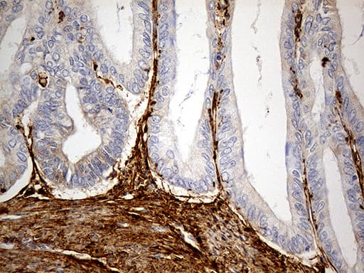 Monoclonal Mouse anti-Human MRC2 / Endo180 Antibody (clone OTI9G4, IHC, WB)