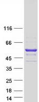 Human GLUD2 Protein (Recombinant Myc-DDK (Flag))