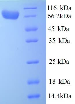 Human IDUA / MPS1 Protein (Recombinant His)