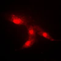 CRABP2 Antibody (Internal)