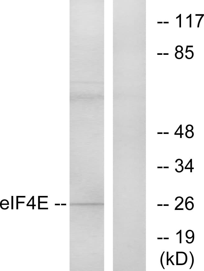 IHC-plus™ EIF4E Antibody (aa168-217)