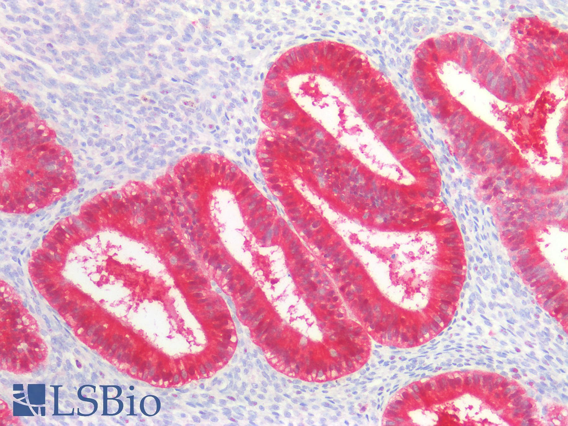 PathPlus™ IDH1 / IDH Antibody (clone AT25H10)