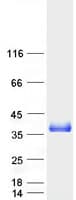Human TXNDC1 / TMX1 Protein (Recombinant Myc-DDK (Flag))