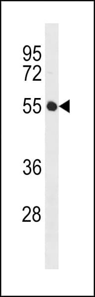 IGSF21 Antibody (aa87-115)