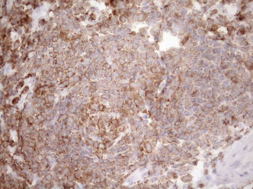 URP2 / FERMT3 Antibody (aa259-528, clone OTI2G2)