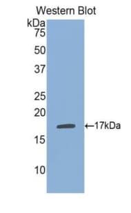 PSPLA1 / Phospholipase A1 Antibody (aa148-295)