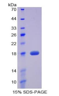 Mouse Preprovasopressin Protein (Recombinant His)