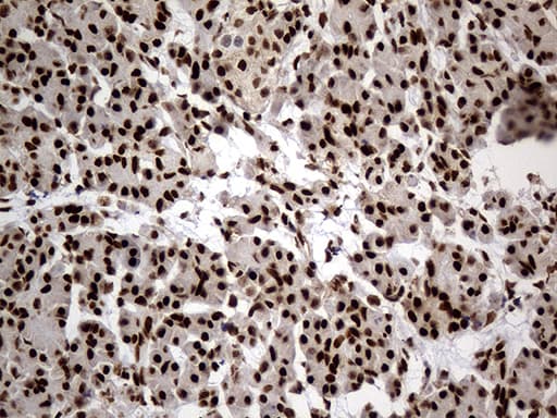 Monoclonal Mouse anti-Human HNRNPH1 / hnRNP H Antibody (clone OTI1H3, Carrier-free, IHC, WB)