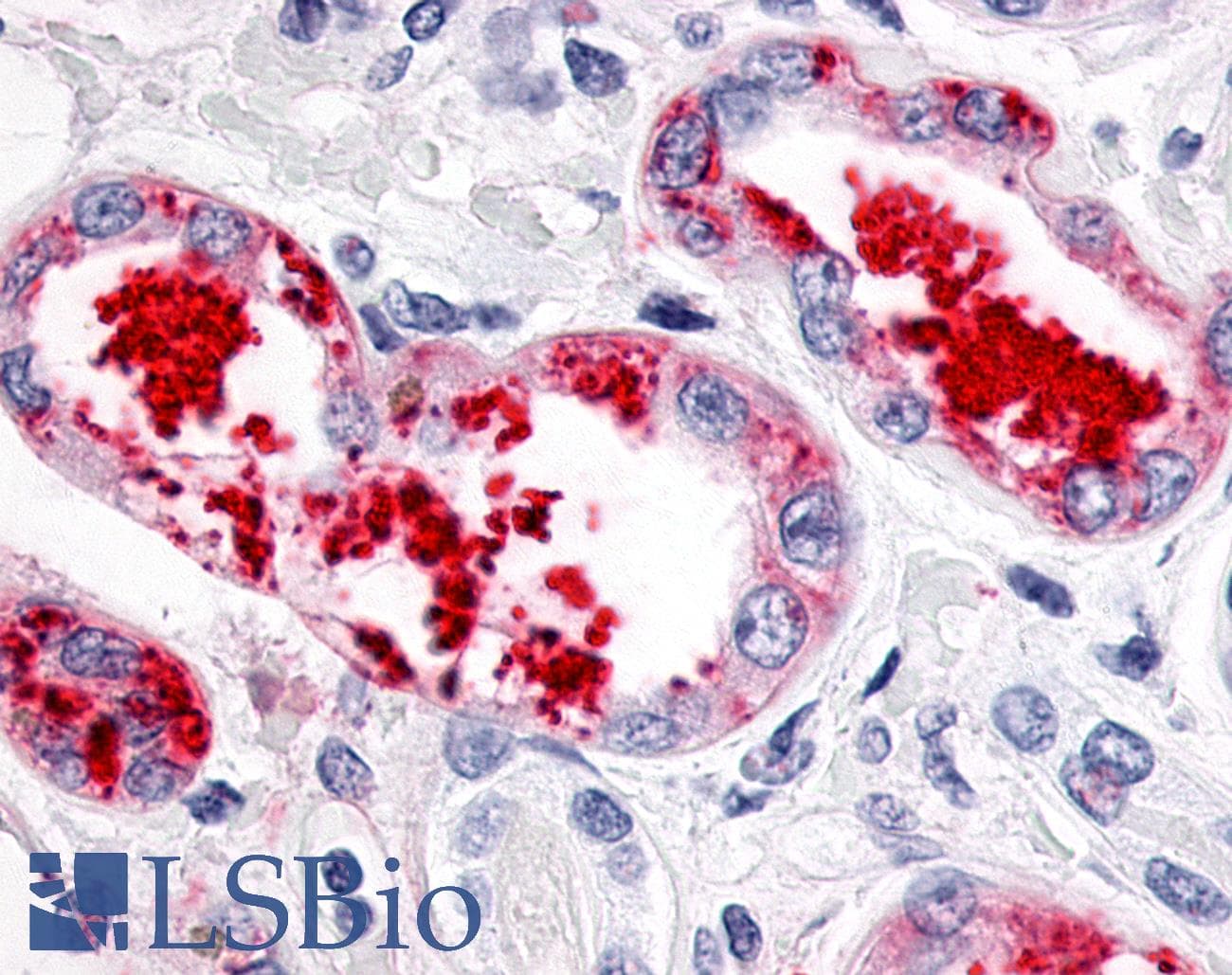 PathPlus™ Polyclonal Rabbit anti-Human ESRRG / ERR Gamma Antibody (C-Terminus, IHC, WB)