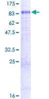 Human SLC7A1 / CAT1 Protein (Recombinant GST)
