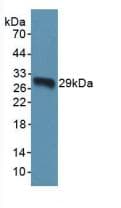 TOR1A / Torsin A Antibody (aa33-321)