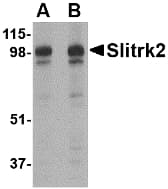 IHC-plus™ SLITRK2 Antibody