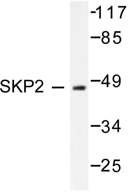 Polyclonal Rabbit anti-Human SKP2 Antibody (Pro399, IHC, IF, WB)