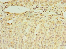 RNF212 Antibody (aa1-297)