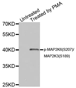 MAP2K6 / MEK6 / MKK6 Antibody (phospho-Ser207)