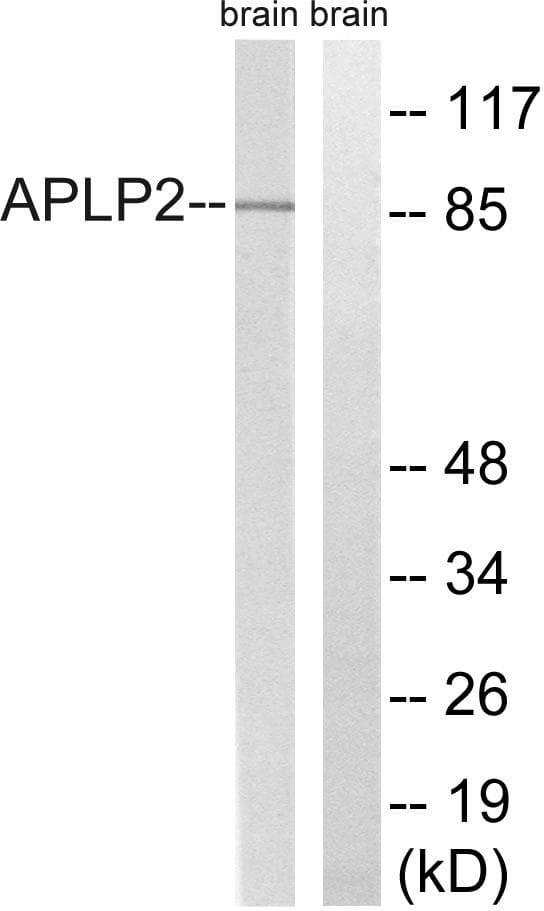 Polyclonal Rabbit anti-Human APLP2 Antibody (p755, WB)