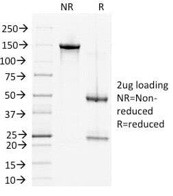 DSG2 / Desmoglein 2 Antibody (clone 6D8)