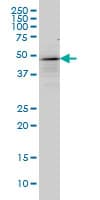 Monoclonal Mouse anti-Human TP53 / p53 Antibody (clone 2C3, IF, WB)