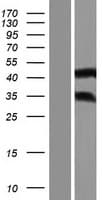 ANKRD63 Protein (Over-Expression Lysate Myc-DDK (Flag))
