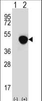 Polyclonal Rabbit anti-Human LRG1 / LRG Antibody (aa86-114, IHC, WB)