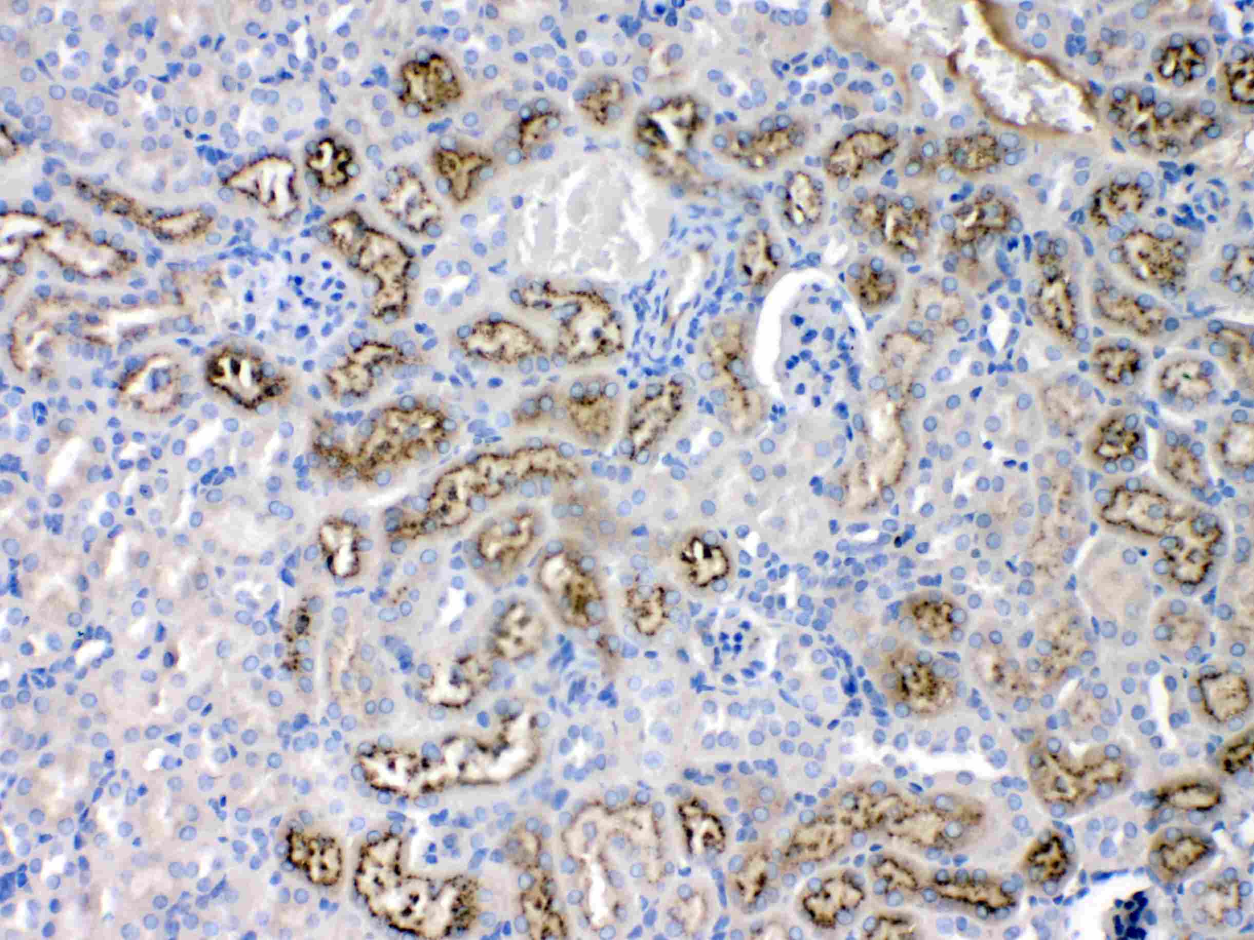 AGT / Angiotensinogen Antibody