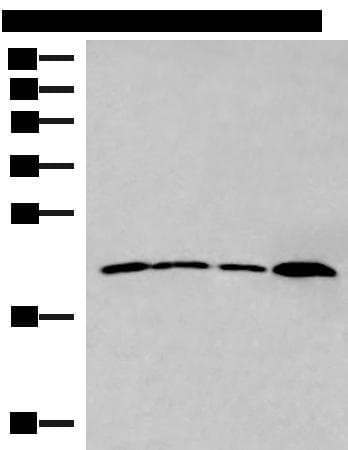 Polyclonal Rabbit anti-Human IFNA5 / Interferon Alpha 5 Antibody (WB)