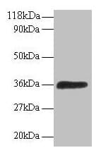 ATP6E / ATP6V1E1 Antibody