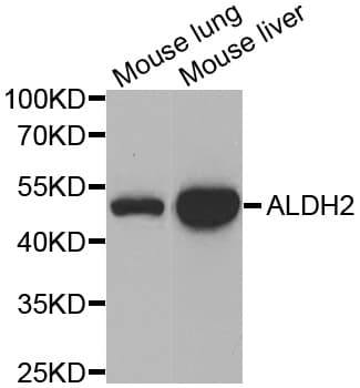 Polyclonal Rabbit anti-Human ALDH2 Antibody (IHC, IF, WB)