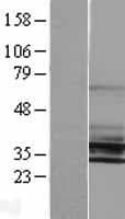 KCNK6 / TWIK-2 Protein (Over-Expression Lysate Myc-DDK (Flag))