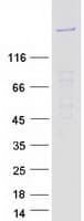 Human FRMPD4 Protein (Recombinant Myc-DDK (Flag))