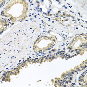 Polyclonal Rabbit anti-Human STXBP2 Antibody (IHC, IF, WB)