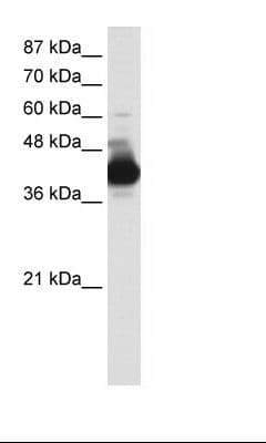 CSTF3 Antibody (aa71-120)