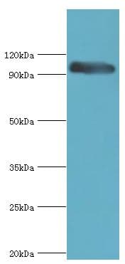 CAPN3 / Calpain 3 Antibody (aa582-821)