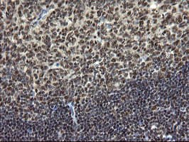 Mannose Phosphate Isomerase Antibody (clone OTI4G7)