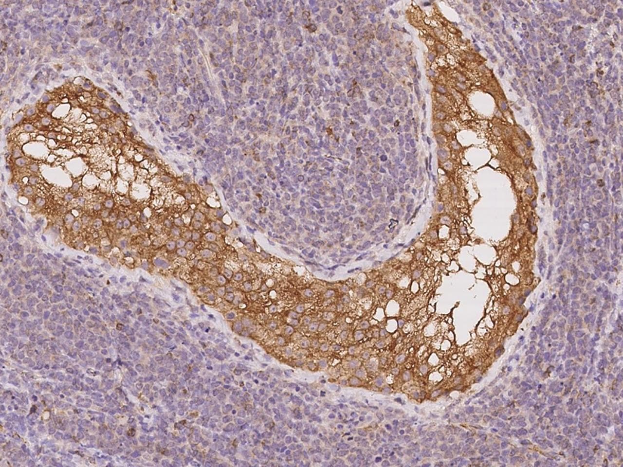 Polyclonal Rabbit anti-Human ZFP57 Antibody (IHC)