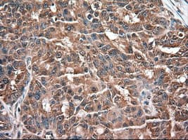 NTF3 / Neurotrophin 3 Antibody (clone OTI5C7)