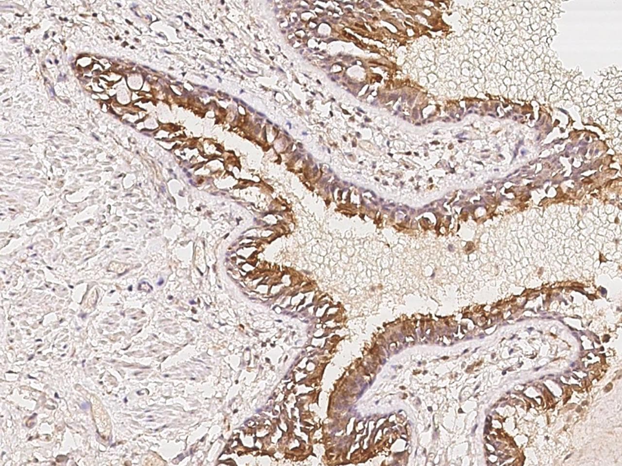 MAPRE3 / EB3 Antibody
