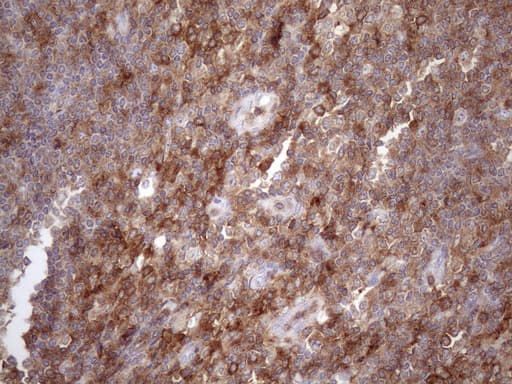 LIME1 / LIME Antibody (aa30-295, clone OTI5D3, Carrier-free)