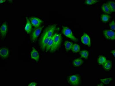 Polyclonal Rabbit anti-Human AQP10 / Aquaporin 10 Antibody (IF)