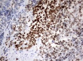 MKI67 / Ki67 Antibody (aa1160-1493, clone OTI13B11)