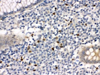 Polyclonal Rabbit anti-Human MMP8 Antibody (IHC, WB)