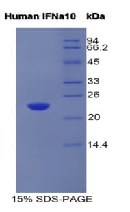 Human IFNA10 / Interferon Alpha 10 Protein (Recombinant His)