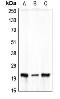 CLDN7 / Claudin 7 Antibody (C-Terminus)