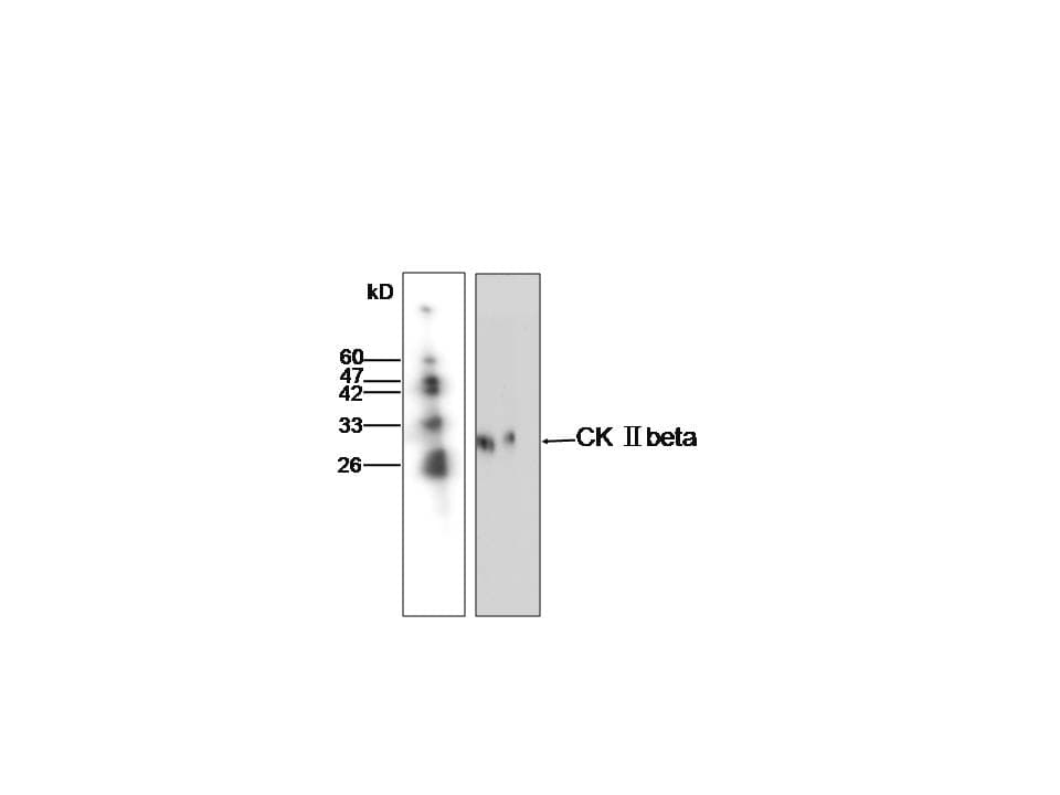 CSNK2B / Phosvitin Antibody