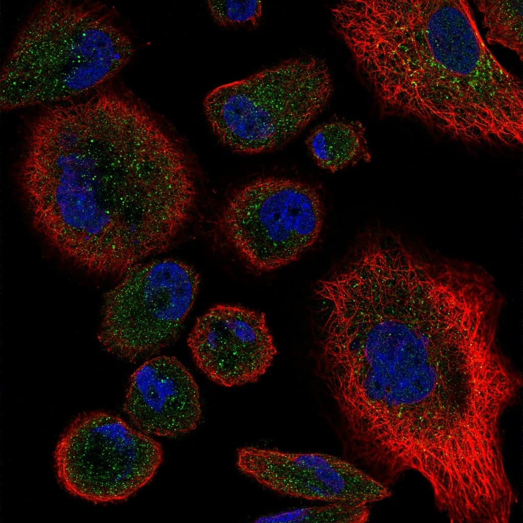 TNFRSF1B / TNFR2 Antibody