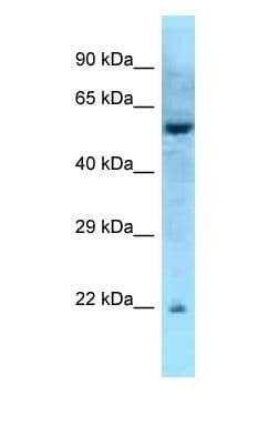 Polyclonal Rabbit anti-Mouse RAB27A / RAB27 Antibody (aa91-140, WB)
