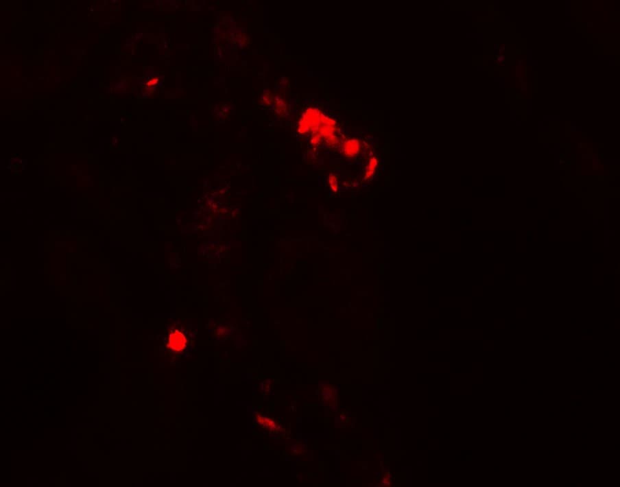 KIAA0226 / RUBICON Antibody