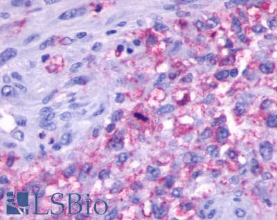 PathPlus™ GPR137 Antibody (Extracellular Domain)