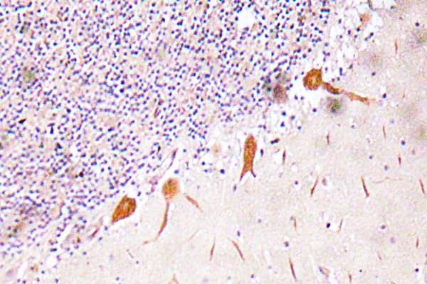 CBFA1 / RUNX2 Antibody (aa229-278)